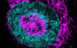 Phát hiện cơ chế “bật năng lượng” khiến tế bào ung thư có thể sống sót