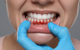 Nướu răng khỏe mạnh không khó: 1 thay đổi nhỏ trong bữa ăn, hiệu quả bất ngờ