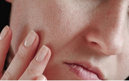 11 bí quyết giữ ẩm da hiệu quả mùa đông