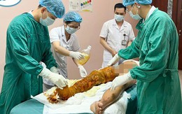 Bé 12 tuổi ở Hà Nội bỏng nặng do tự nghịch cồn trong nhà tắm