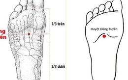 Bác sĩ y học cổ truyền khuyến cáo một số biện pháp phòng ngừa đột quỵ vào mùa lạnh