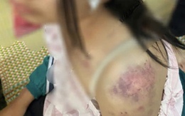 Góc pháp lý vụ bà nội bạo hành cháu gái ở Thái Nguyên