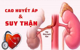 Huyết áp tăng cao, người phụ nữ 39 tuổi đi khám bất ngờ phát hiện nguy cơ mắc bệnh thận mạn