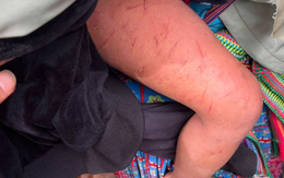 Đêm mưa rét kinh hoàng của bé 4 tuổi lạc trong rừng cao su