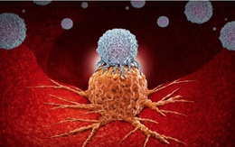 Tế bào ung thư sợ gì nhất?: Người Việt cần làm đúng và hiểu đúng để phòng bệnh