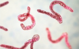 Người đàn ông 39 tuổi đột ngột phát hiện nhiễm sán não trong lần đi khám vì đau đầu