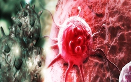 Tế bào ung thư có thể bị 'kìm hãm' từ trong mâm cơm nhà bạn: 7 thực phẩm người Việt nên kiểm soát