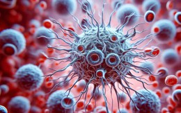 Thói quen ăn uống tạo tiền đề cho tế bào ung thư: Nhiều người Việt đang lặp lại mỗi ngày