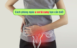 Cách phòng ngừa u xơ tử cung bạn cần biết
