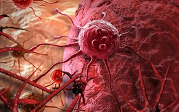 Tế bào ung thư 'sợ' nhất 5 thực phẩm rẻ tiền này, người Việt tăng cường ăn để ngừa bệnh, kéo dài tuổi thọ