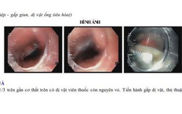 Người đàn ông ở Ninh Bình nhập viện gấp do bất cẩn khi uống thuốc