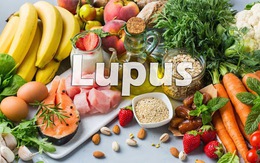 Người bệnh lupus ban đỏ nên ăn gì để kiểm soát tốt bệnh?