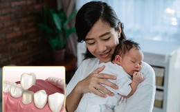 Đang cho con bú có bọc răng sứ được không?