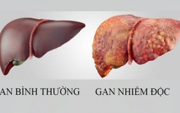 Loại quả mùa hè rẻ tiền, ngọt mát giúp làm mát gan, người Việt dùng vào thời điểm này để giúp gan thải độc