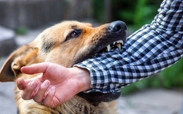 Bé trai 13 tuổi nguy kịch sau 2 tháng bị chó cắn vì việc làm này của người thân