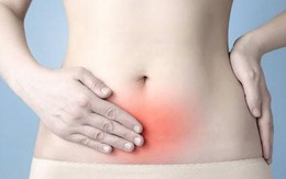 Vì sao viêm phụ khoa dễ tái đi tái lại?