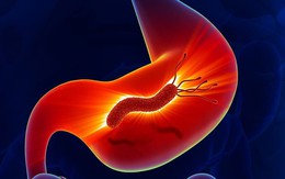 Người đàn ông phát hiện cùng lúc 5 bệnh từ dấu hiệu nhiều người Việt bỏ qua