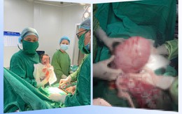 Người phụ nữ 30 tuổi vừa mang thai vừa có khối u xơ tử cung 'khủng' trong bụng