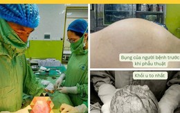 Người phụ nữ 42 tuổi ở Hòa Bình có khối u xơ tử cung 'khủng' như mang thai 3 tháng từ sai lầm nhiều chị em Việt mắc phải