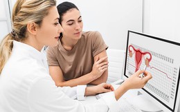 Khắc phục tình trạng giãn âm đạo cách nào?