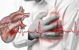 Các yếu tố nguy cơ gây nhồi máu cơ tim