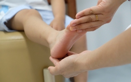 Sưng đau cổ chân phải sau khi chơi bóng rổ, tái phát nhiều lần, bé trai 11 tuổi được phát hiện có bàn chân bẹt hai bên