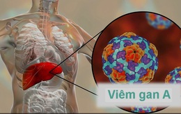 Lưu ý 6 nhóm thực phẩm gây hại gan, không nên ăn để phòng bệnh viêm gan A