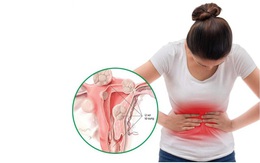 Người phụ nữ 39 tuổi phát hiện khối u hiếm gặp trong tử cung từ dấu hiệu nhiều chị em Việt mắc phải