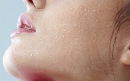 Nếu da khô, bong tróc, cẩn thận dấu hiệu của suy giáp và 5 dấu hiệu bất thường trên da cảnh báo sức khỏe