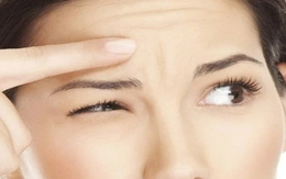 Nếp nhăn trán khi còn trẻ, làm sao để mờ dần?