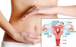 Người phụ nữ 48 tuổi ở Phú Thọ phát hiện u xơ tử cung nặng hơn 1,5kg từ dấu hiệu nhiều chị em Việt bỏ qua