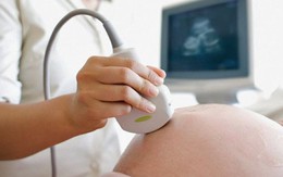 Các mốc siêu âm dị tật thai nhi quan trọng mẹ bầu cần ghi nhớ để có một thai kỳ khỏe mạnh