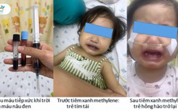 Bé 16 tháng tuổi nguy kịch sau bữa ăn trưa do mẹ nấu, bác sĩ chỉ rõ nguyên nhân