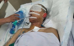 MS 1014: Sự sống mong manh của nam sinh lớp 12 bị sét đánh nguy kịch khi đi phụ mẹ ngoài đồng