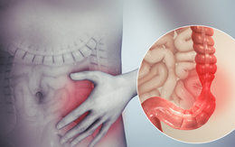 Người đàn ông 67 tuổi ở Hà Nội phát hiện ung thư đại tràng thừa nhận chủ quan với dấu hiệu báo bệnh này