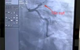 Người đàn ông 43 tuổi đột ngột nhồi máu cơ tim ngay trên đường đi làm thừa nhận có thói quen này