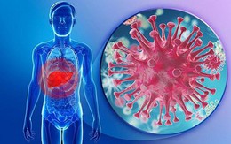 Người đàn ông 34 tuổi ở Hà Nội bị xơ gan thừa nhận 1 sai lầm khi điều trị viêm gan B nhiều người Việt mắc phải