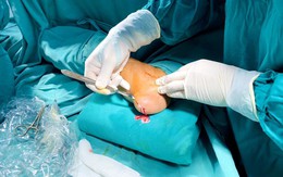 Cảnh giác với biến chứng nguy hiểm của bệnh gout
