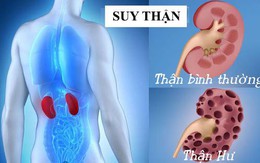 7 việc nên làm để phòng nguy cơ suy thận