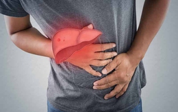 Người phụ nữ tổn thương gan nghiêm trọng do hằng ngày uống loại nước thịnh hành