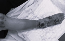 Những cách chữa bệnh xương khớp khiến bác sĩ phải 'lắc đầu' ngao ngán