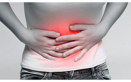 5 loại thực phẩm ‘thúc đẩy’ ung thư dạ dày