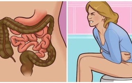 8 dấu hiệu ung thư trực tràng dễ nhận biết nhưng thường bị bỏ qua