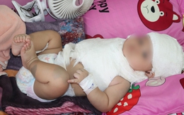 Phẫu thuật phục hồi đám rối thần cánh tay cho bé 5 tháng tuổi do chấn thương sản khoa