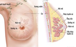 6 nhóm người có nguy cơ mắc ung thư vú cao, đây là 7 dấu hiệu cảnh báo bệnh, chị em cần cảnh giác