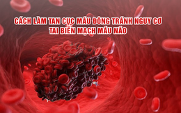 Cách hỗ trợ làm tan cục máu đông tránh nguy cơ tai biến mạch máu não