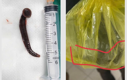 Người đàn ông bị đỉa chui vào niệu đạo trong lúc làm việc ngoài đồng