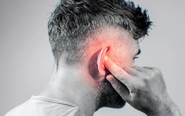 Người đàn ông 52 tuổi ở Hà Nội phát hiện nhồi máu não bán cấp sau 2 tuần có biểu hiện này
