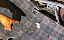 Nổ cục sạc điện thoại tự chế, người đàn ông phải bị chấn thương nặng