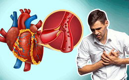 Bệnh nhồi máu cơ tim: Liên tiếp nhiều người bệnh được cứu sống nhờ làm tốt việc này!
